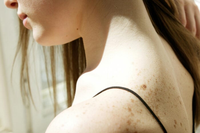 Femme avec la peau claire et des tâches de rousseur © Hanna Pad
- Pexels