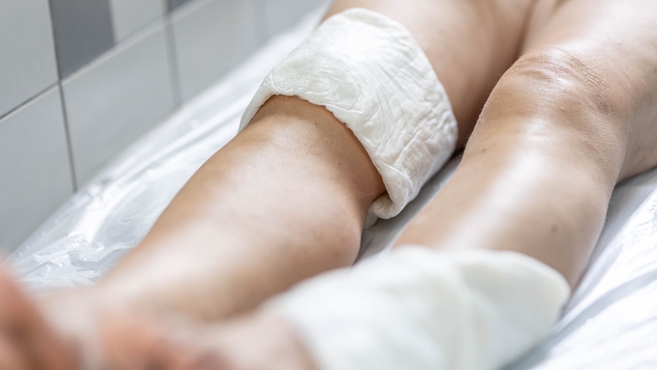 Femme en cure prévention santé rhumatologie aux thermes Salies-deBearn
