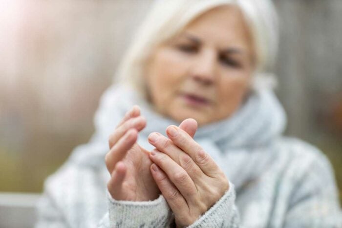 La cure thermale pour la rhizarthrose (arthrose du pouce)