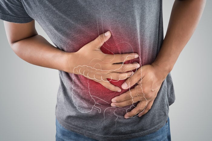 Maladie de Crohn