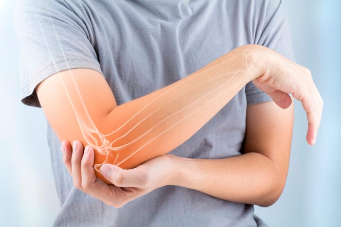 Suites de fracture cure thermale